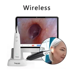 Video Wireless UHD Otoscope Ear Camera Digital Image Capture Ear Care Cleaning Hearing Aid Screening Tools Ear Canal Examination
