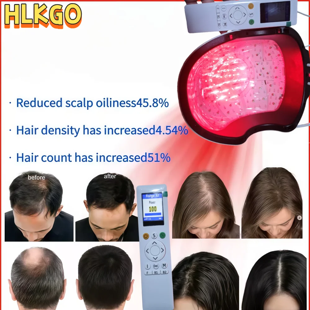 

Professional Anti Hair Loss Red Light Cap, 6750mW 650nm/660nm Laser Therapy for Hair Regrowth, Infrared Beads Scalp Care