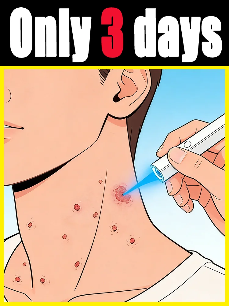 

Say goodbye to the embarrassmentᵃⁿᵈ ᵖᵃⁱⁿ ᶜᵃᵘˢᵉᵈ ᵇʸ ʷᵃʳᵗˢ⸴ ⁿᵒ ⁿᵉᵉᵈ ᵗᵒ ʷᵃⁱᵗ ᵒʳ ᵉⁿᵈᵘʳᵉ ⁱ