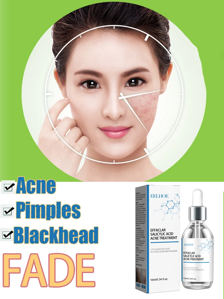 3RD محلول حمض الساليسيليك جوهر حب الشباب إزالة بقعة تقليص المسام السيطرة على النفط سطع المصل ، تقليل حب الشباب ، ترطيب ، تهدئة