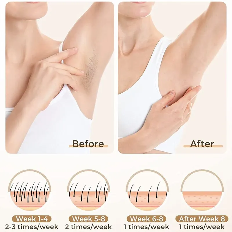 جهاز إزالة حب الشباب جهاز إزالة الشعر بوضعيات مزدوجة مزيل شعر مضاد لحب الشباب 3 في 1 للنساء والرجال