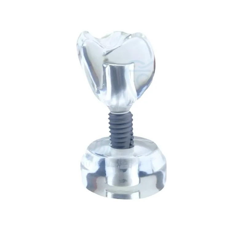 Crystal implant model, transparent model, teaching doctor-patient communication model teaching