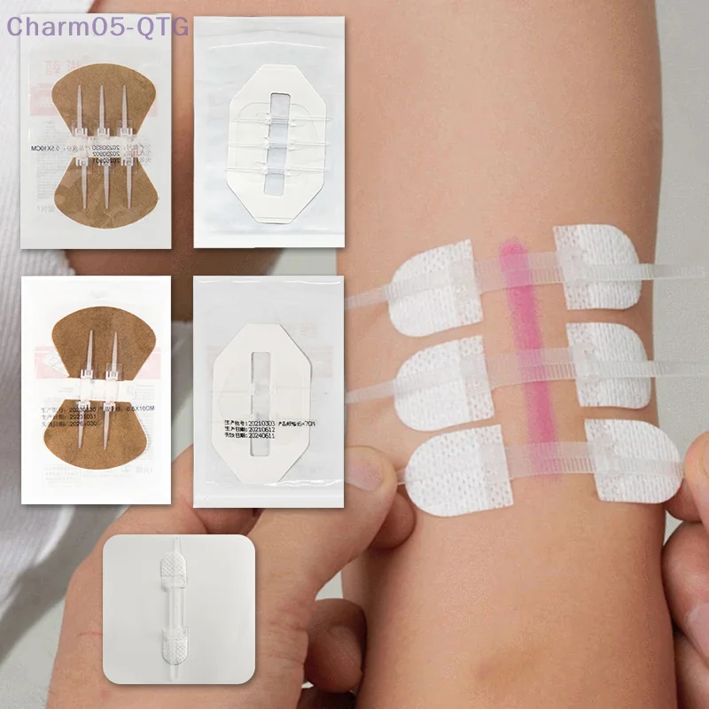 

Zipper Tie Wound Closure Patch Hemostatic Patch Wound Fast Without Suture Zipper Outdoor Band-Aid Portable Quick Clot Wound