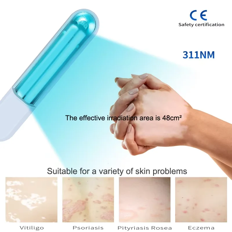 

311nm Uvb Phototherapy Narrow band Uv Phototherapy Lamp Uvb Light Therapy Psoriasis For Vitiligo