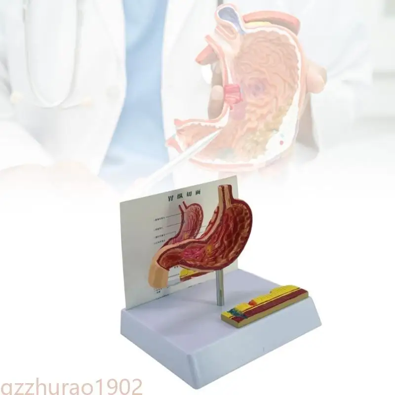 

97QB Realistic Gastric Perforation Anatomy Model Pathological Stomach Anatomy Model for Teaching Research Clinical Settings