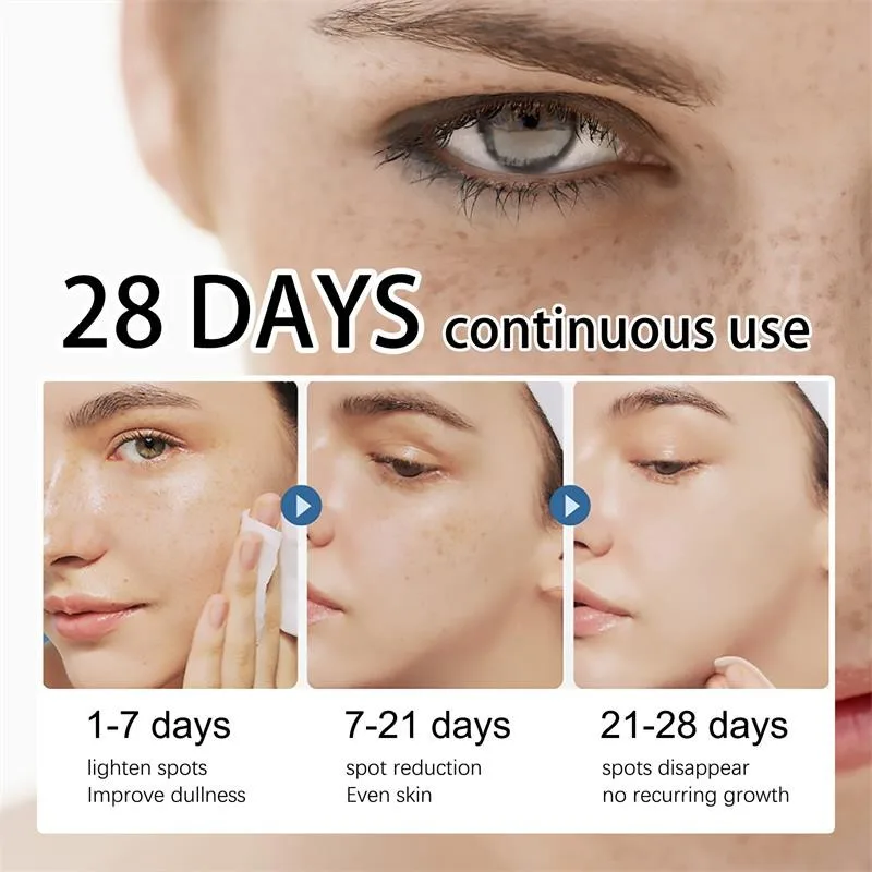 Women Fade Melasma Cream Lightening Dull Brightening Emulsion Remove Dark Stains Brighten Cream Dark Skin Moisturize Products