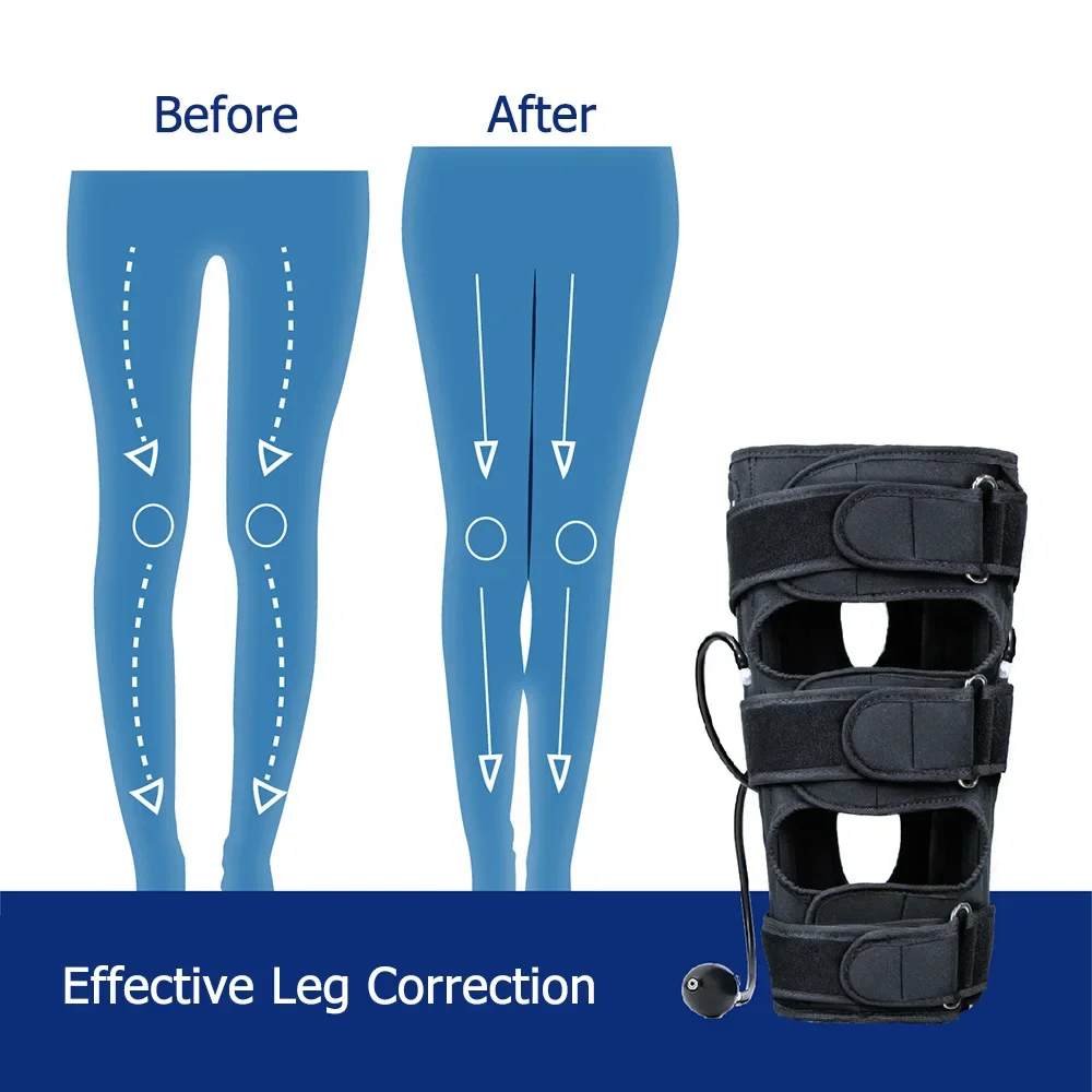 Pressure O/X Type Leg Posture Correction Strap Bent Leg Knee Valgus Straight Beauty Inflatable Leg Strap Adult Children Support view 6