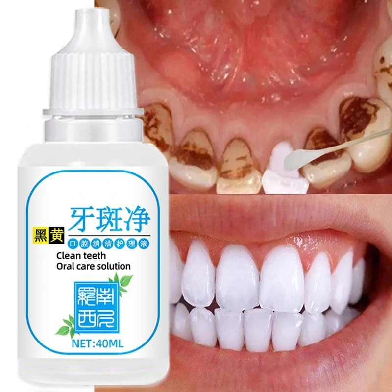 

(10-40ml) Tooth Whitening Essence Oral Hygiene Cleaning Effectively Removes Plaque Stains Yellow Tooth Whitening Fresh Breath