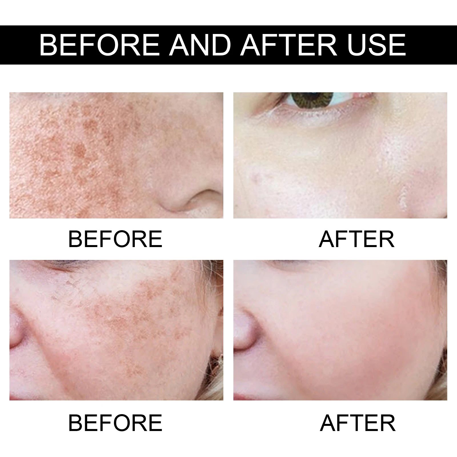 Women Fade Melasma Cream Lightening Dull Brightening Emulsion Remove Dark Stains Brighten Cream Dark Skin Moisturize Products