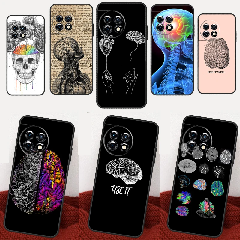 Medical Human Organs Brain Case For Oneplus 10T 11 8T 9RT 10R 8 9 10 Pro Nord 2T N10 N20 N30 CE 2 3 Lite Back Cover