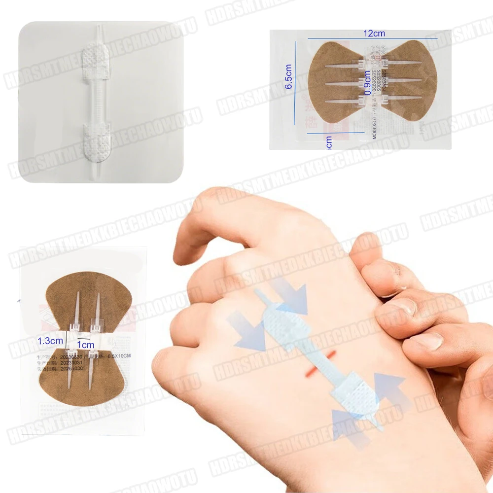 

5-100Pcs Zipper Bandage Painless Wound Closure Device Suture-free Wound Dressing Patches Zip Suture Reducer Bandage Tape Sticker