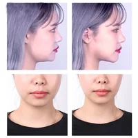 40-120PCS V-Shape Face Wrinkle Sagging Skin Adhesive Tape Lifting Face Stickers Invisible Transparent Thin Face Patche Lift Tool 5