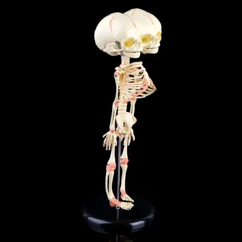 

Human Baby Deformed for Head Skull Research Model Skeleton Anatomical Anatomy Teaching Display H8WD