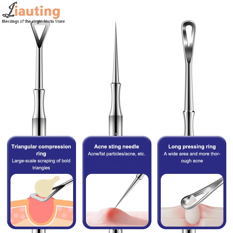 Blackhead Remover สิว Popper เครื่องมือเข็มสิวถอด Treatment Whitehead Popping Zit จมูก Face Blemish EXTRACTOR Cleanser