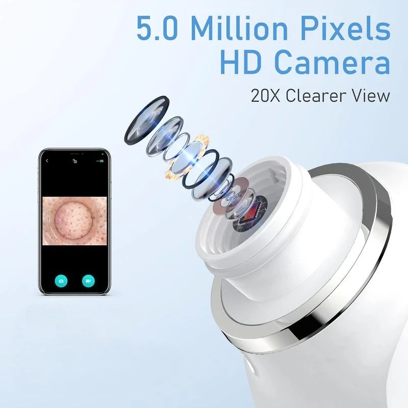 Mee-eterverwijderaar met 500x HD-camera, opladen via USB, 3 zuigniveaus, 6 zuigkoppen, gratis vijfdelige set, unisex poriënvacuüm