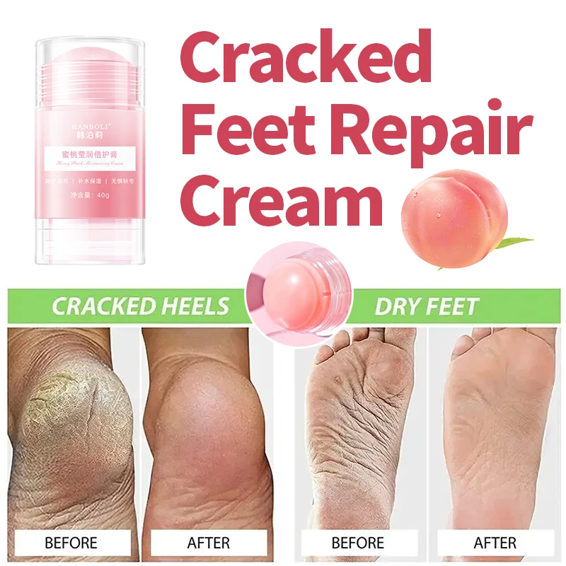 

Anti Crack Foot Cream Drying Cracked Feet Repair Moisturizing Dead Dry Skin Removal Care Heel Cracking Hand Peeling Mask 40g