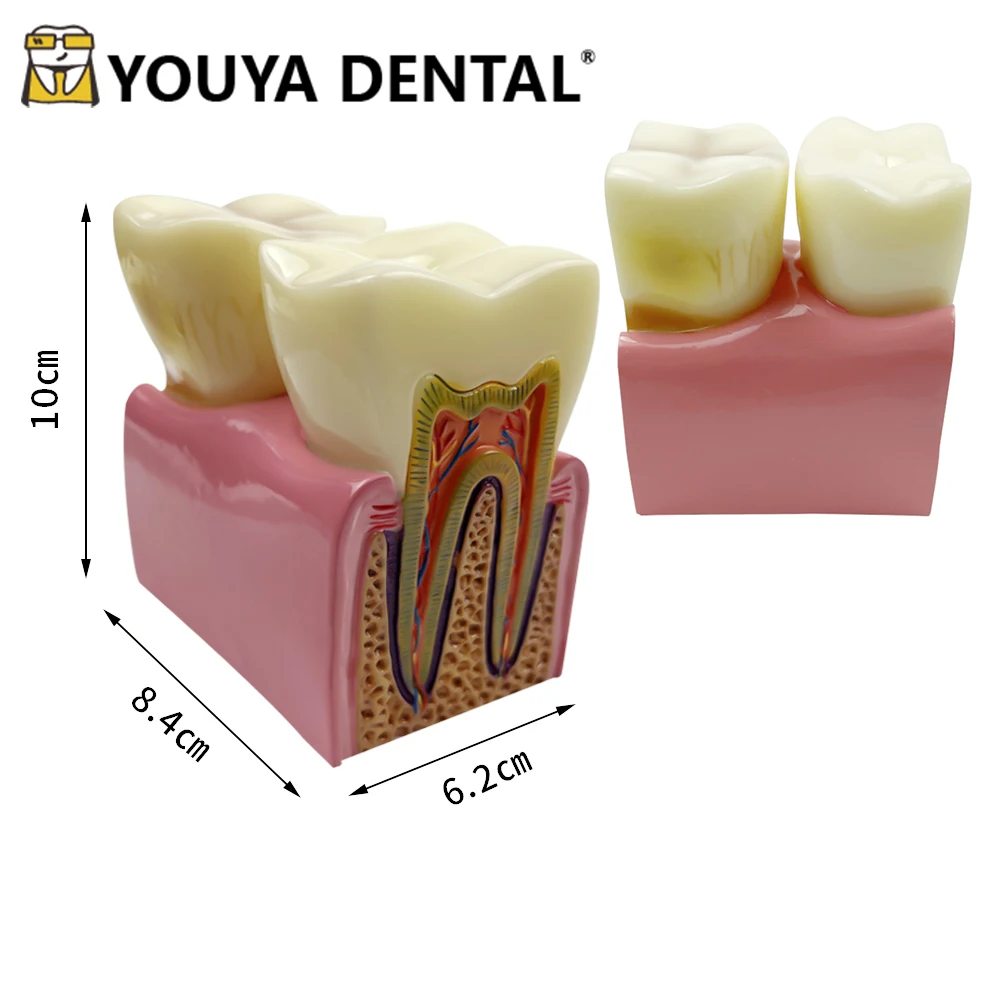 

Dental Anatomy Comparison Models Anatomy Molar Teeth Model for Dentist Technician Student Teaching Practice Training
