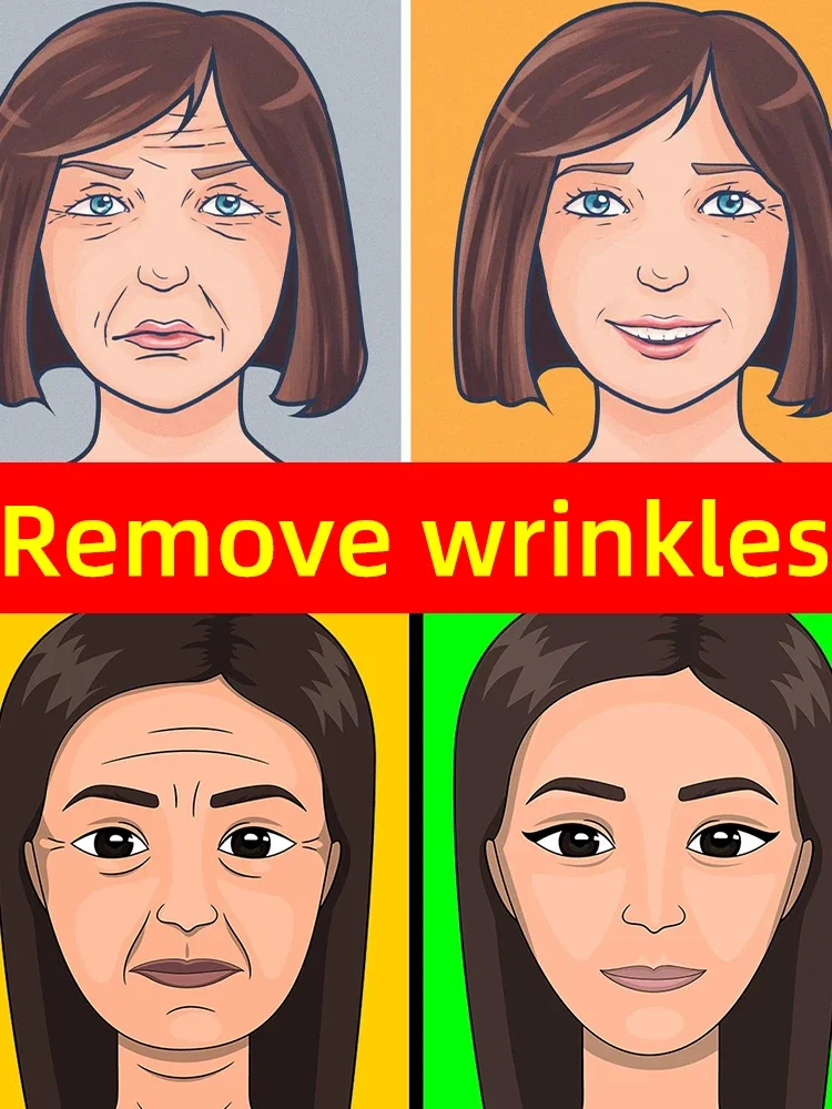 Frown Lines