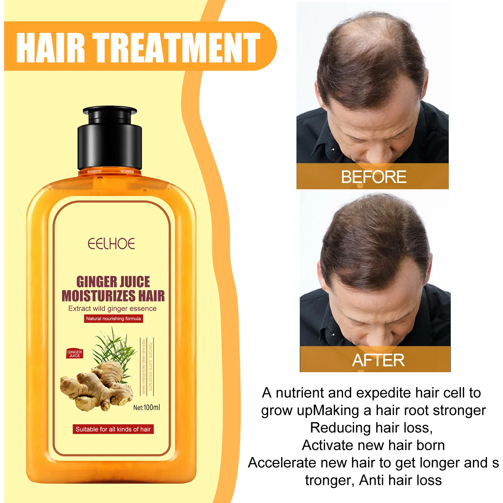 100ml  Professional Hair Ginger Shampoo Hair Regrowth Dense Fast Thicker Hair Growth Shampoo Anti Hair Loss Product