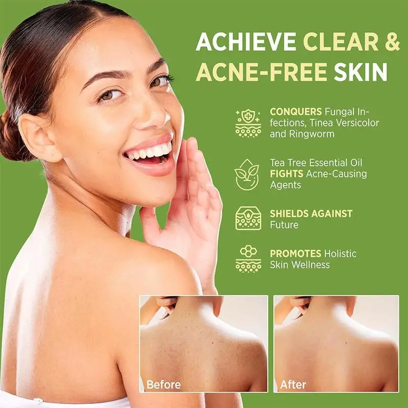 1/2pc Tea Tree Oil Antifungal Soap 115g Body Handmade Soap Deep Cleansing Soap Gentle Exfoliating Bar Soap for All Skin Type view 5