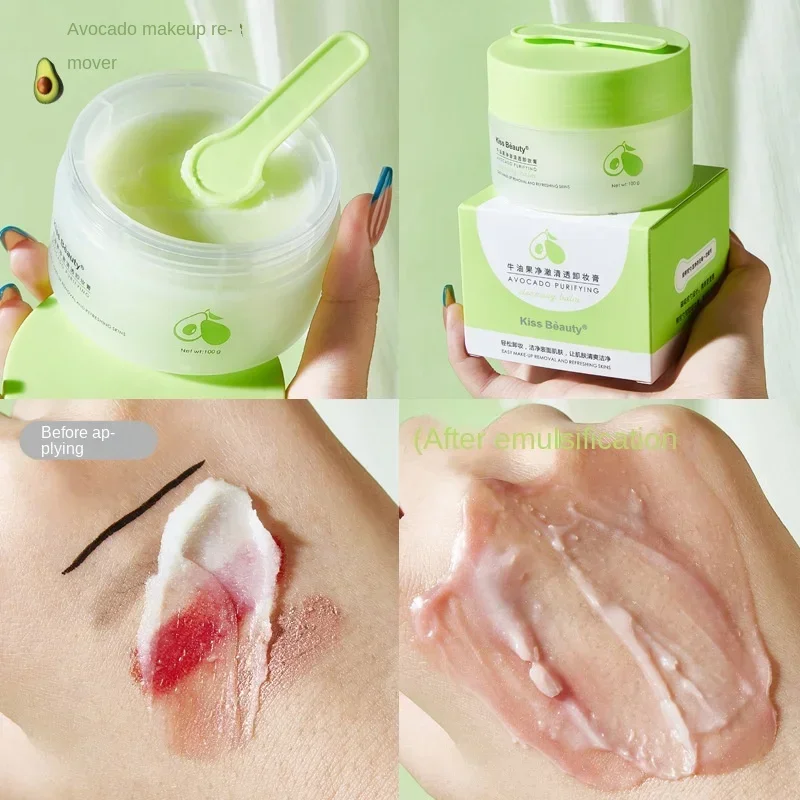 키스 뷰티 한국 스킨케어 아보카도 클렌징 밤 블랙헤드 제거 부드러운 딥 클렌징 클렌징 오일 100G