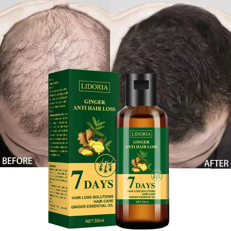 

Ginger Hair Growth Essential Oil Anti-loss Hair Regrowth Serum Repair Nourish Roots Prevent Baldness Products For Men Women Care