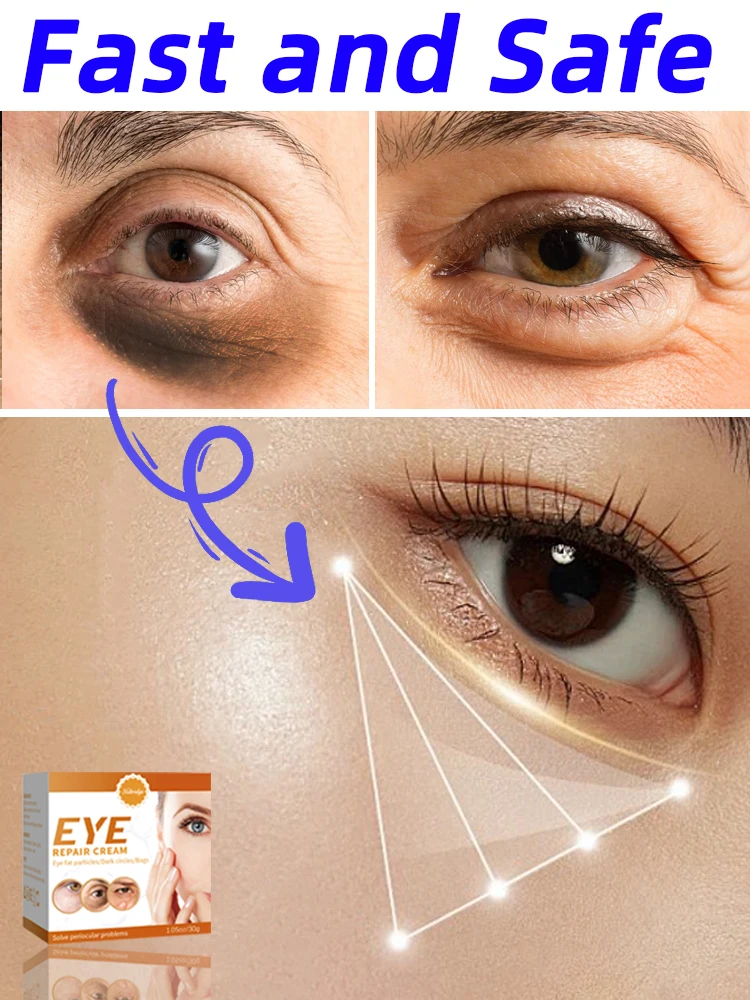 

Eye Cream Eyes Bags Wrinkle Dark Circles