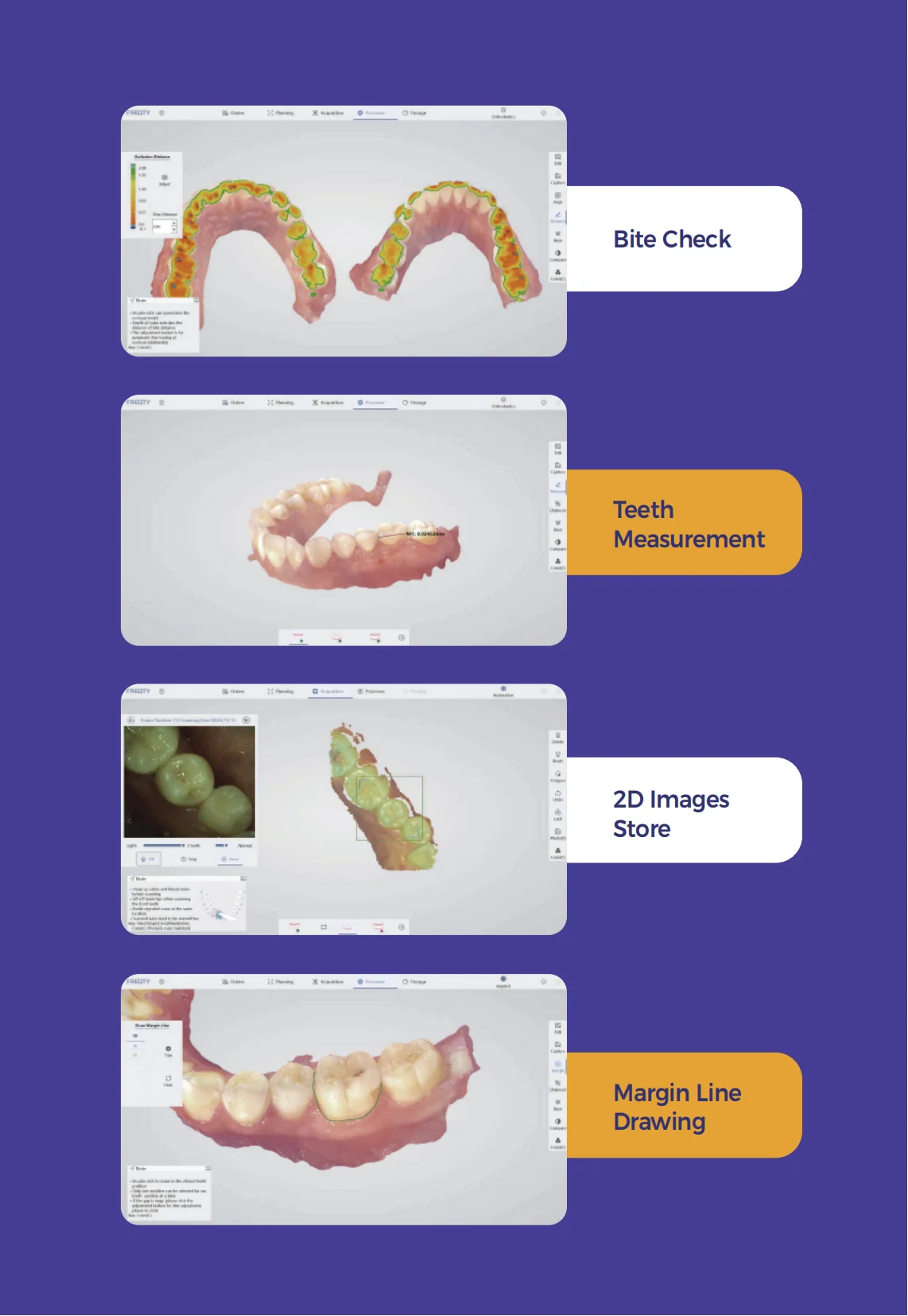 CE Approved 3D Intraoral Scanner Dental Intraoral Digital Impression Instrument with Free Software