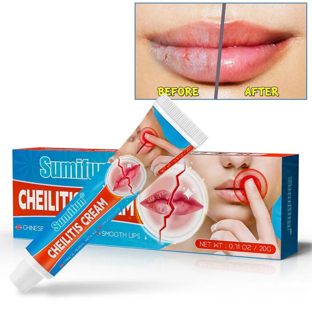 Reduce Fine Lines Lip Balm Cheilitis Treatment Cream Remove Dark Moisturizing Sexy Lips Repairing Anti-Cracking Lip Ointment