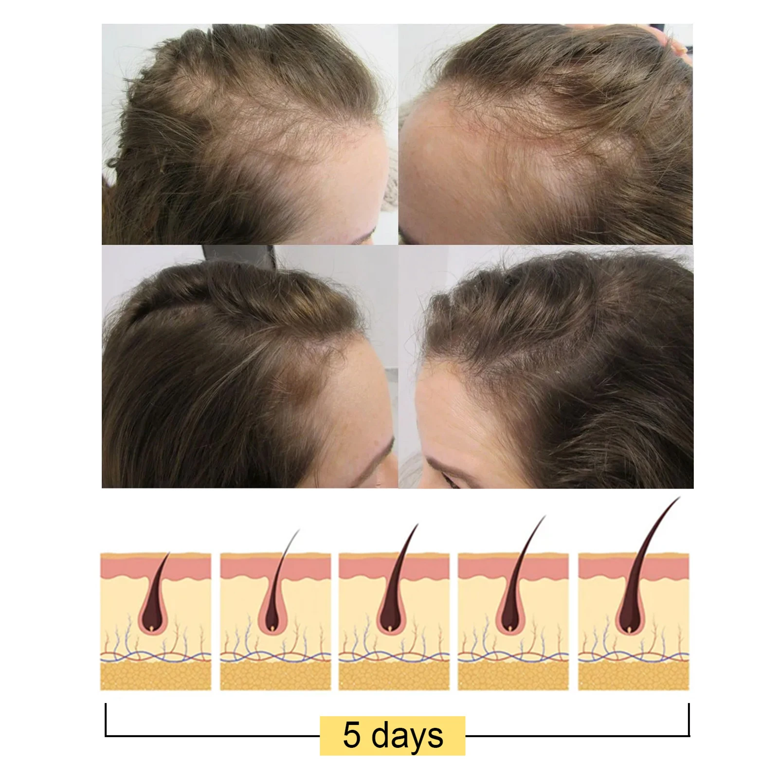 Anti-haaruitval Gember Shampoo Bar Balansolie Verhogend haarvolume Voedt de haarwortel Haargroei Shampoo Bar