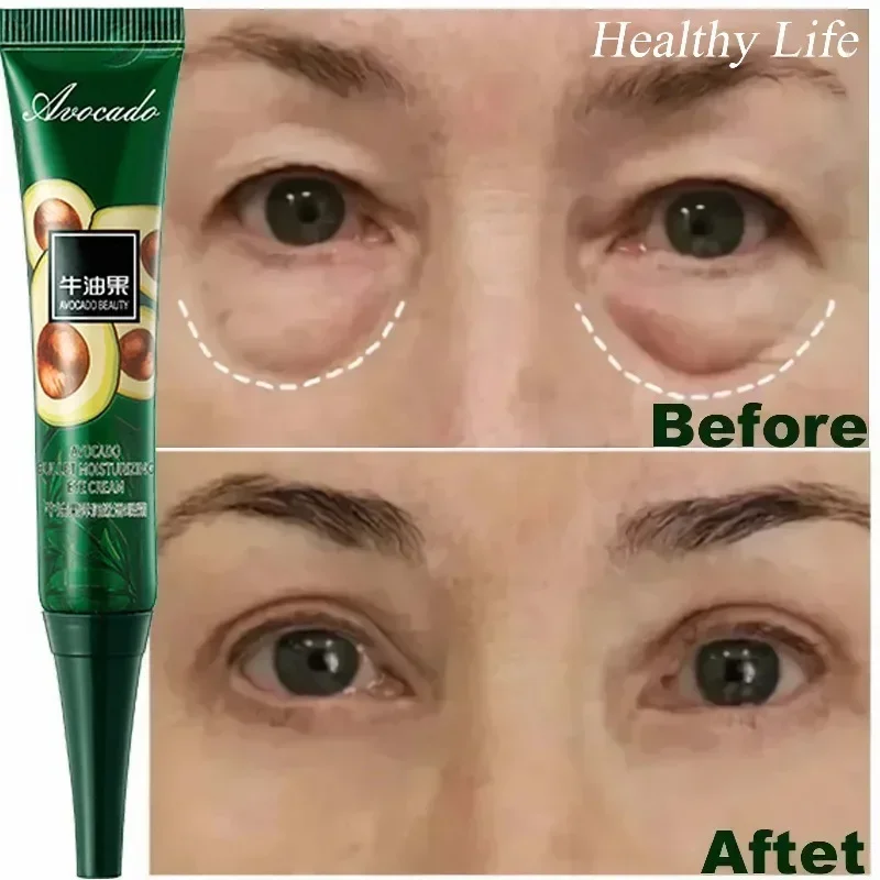 7 Day Tighten Face Eye Cream Anti Dark Circles Bags Puffiness Fade Eye Fine Line Brighten Under Eyes Skin Korean Care New 2024