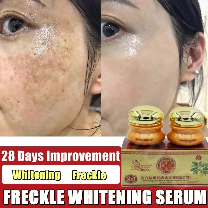 Pimples Melasma Blemish Removal Dark Spot Remover Cream Strong Bleaching Whitening Face Freckles Remove Corrector Cream