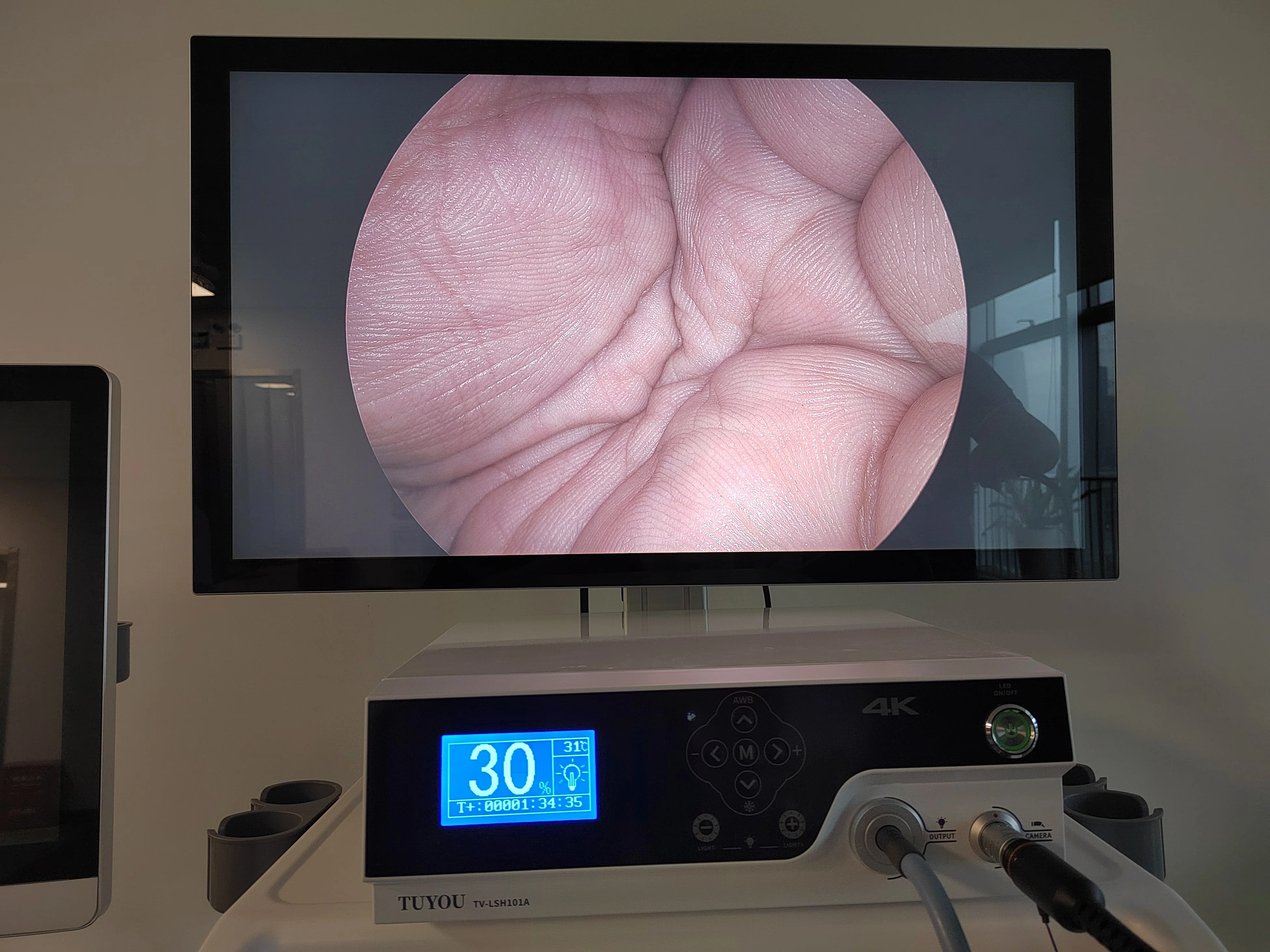 New Product Medical Endoscopic 4K LCD Monitor 27 32 Inch Medical Grade Monitor for Laparoscope Surgery