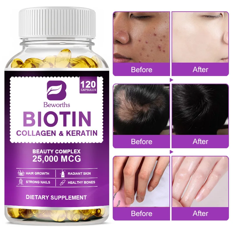 BEWORTHS Collagen and Biotin Capsules Biotin for Hair Growth Healthy Nails &Skin Hair Farming Supplement Beauty Health Skin Care