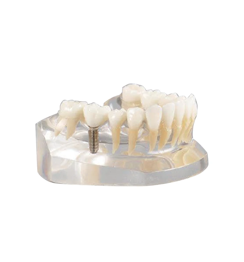 Oral Teaching  Mandible Practice Model