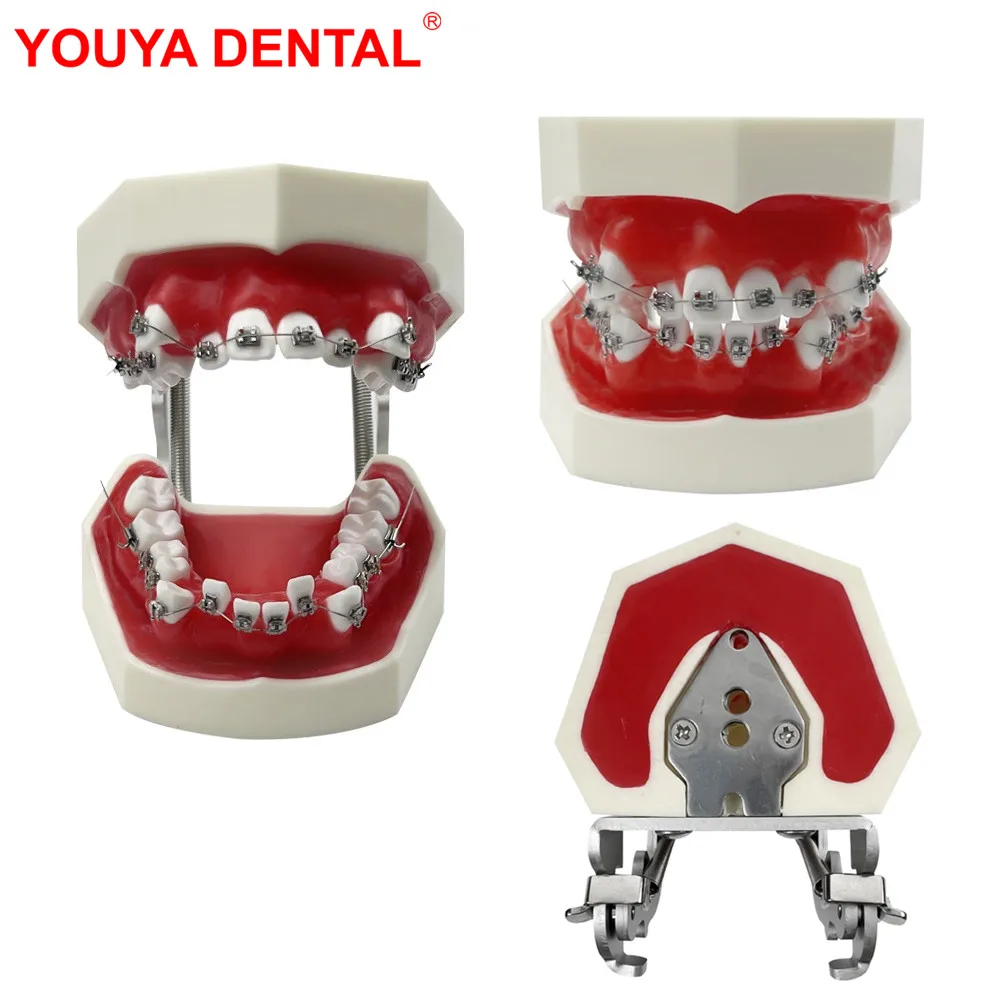 

Wax Gum Orthodontic Teeth Model Dental Practice Typodont With Metal Bracket For Ortho Traning Teaching Studying Education Demo