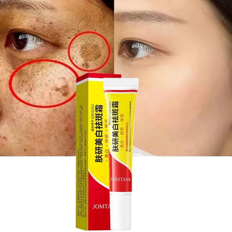 

Whitening Freckle Cream Face Brightening Cream Niacinamide Reduce Chloasma Melasma Melanin Fade Fine Lines Lighten Dark Skincare