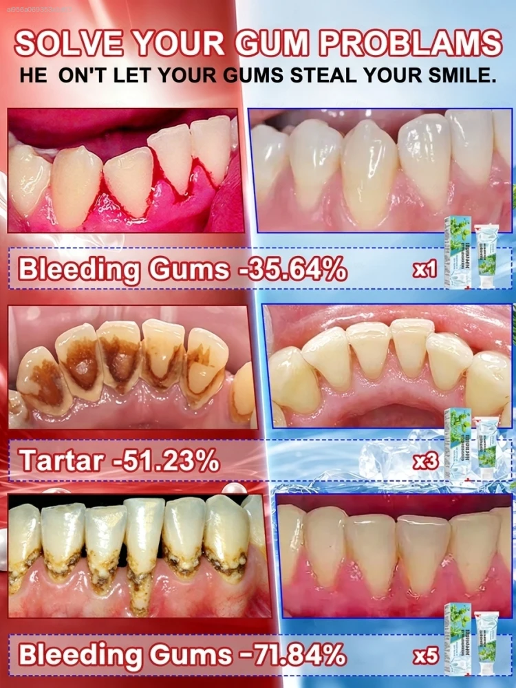 Intensive Probiotic Gum Treatm - đánh giá và giá Teeth Whitening Paste