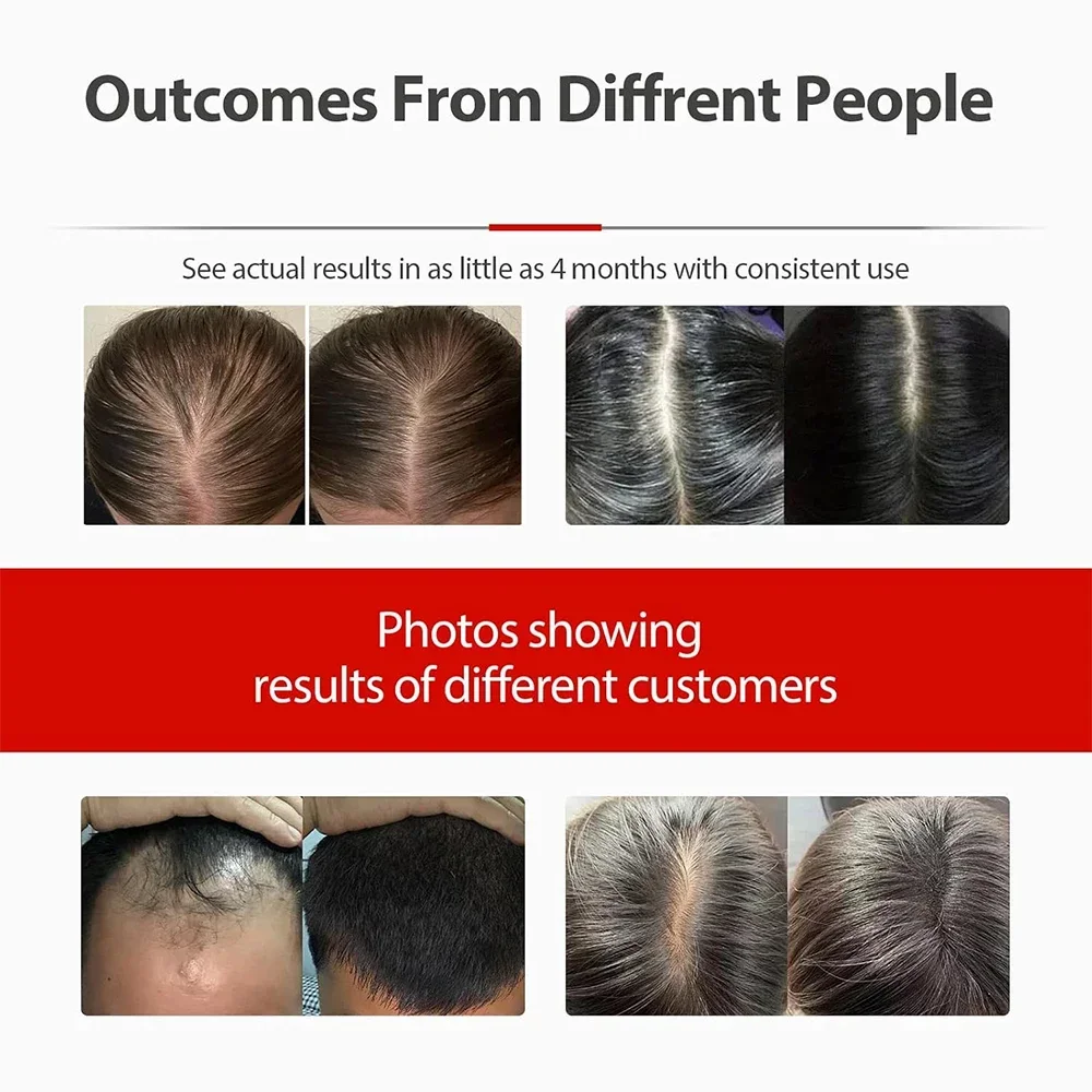 Professional Laser … - image