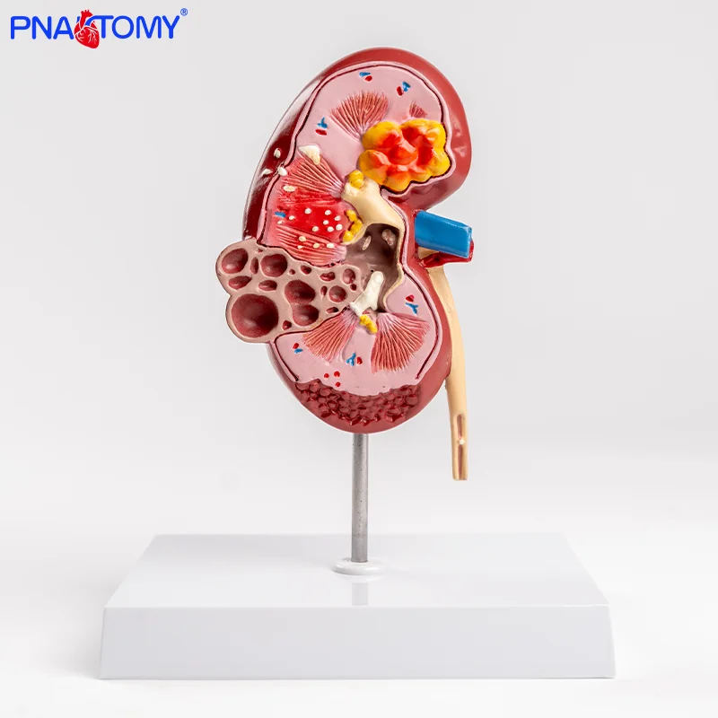 Human Kidney Anatomical Model Medical Teaching Tool for Pathological Structure Urinary System Demonstration Visceral Organ