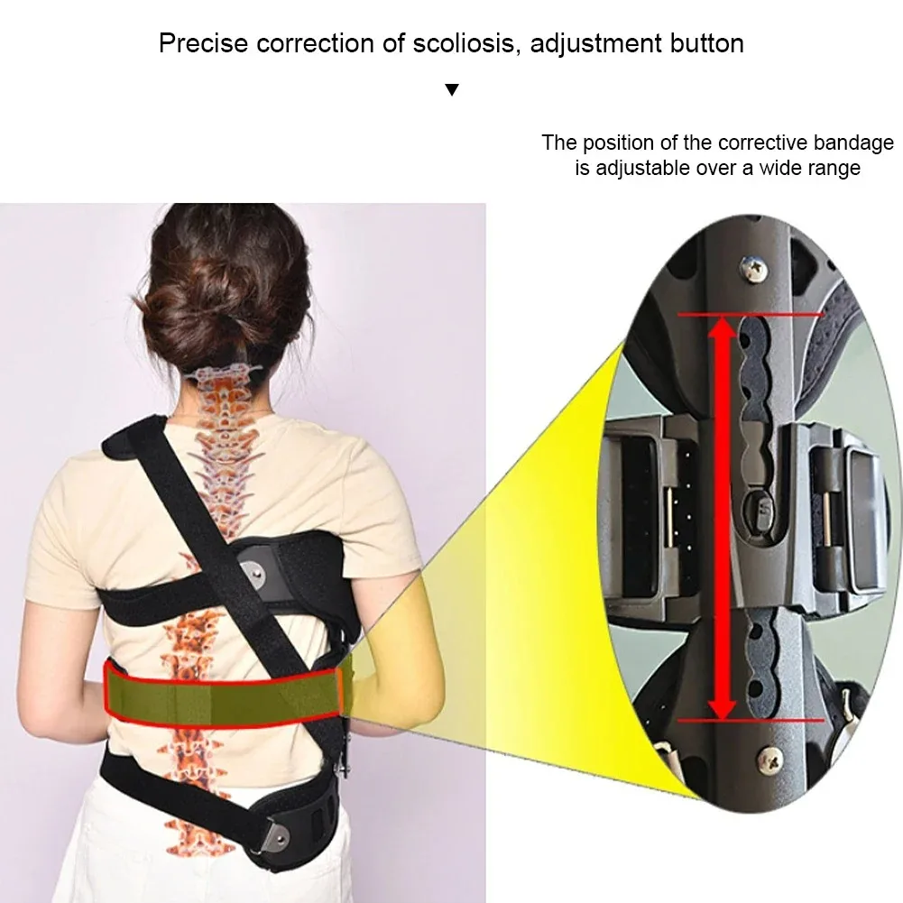 Adjustable Scoliosis Brace Posture Corrector Treatment Spinal Auxiliary Orthosis for Back Postoperative Recovery Left/Right