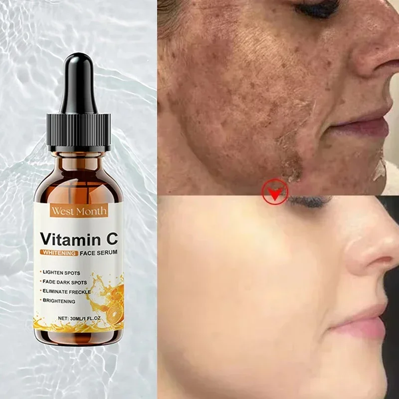 

Vitamin C Whitening Serum Remove Freckles Dark Spots Face Essence Fade Melasma Melanin Brighten Repair Dull Skin Care Cosmetics