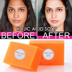 Remove Melanin Kojic Acid Soap Exfoliating Moisturizing Brightening Skin Tone Lifting Skin Firming Handmade Kojic Acid Soap