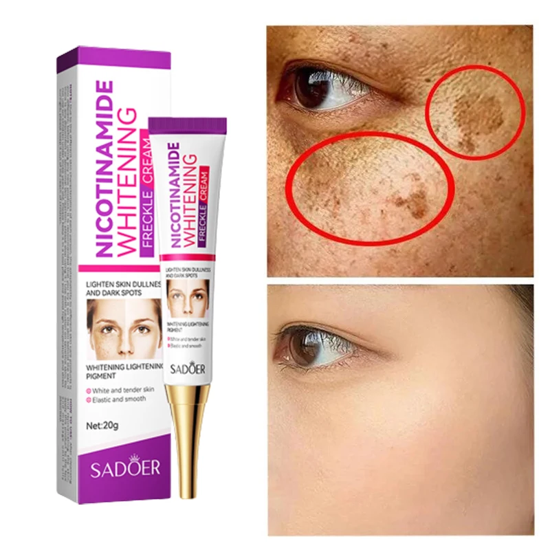 2024 New Niacinamide Whitening Freckle Cream Effectively Removes Melasma Lightens Black Spots Acne Marks Brightens Skin Care