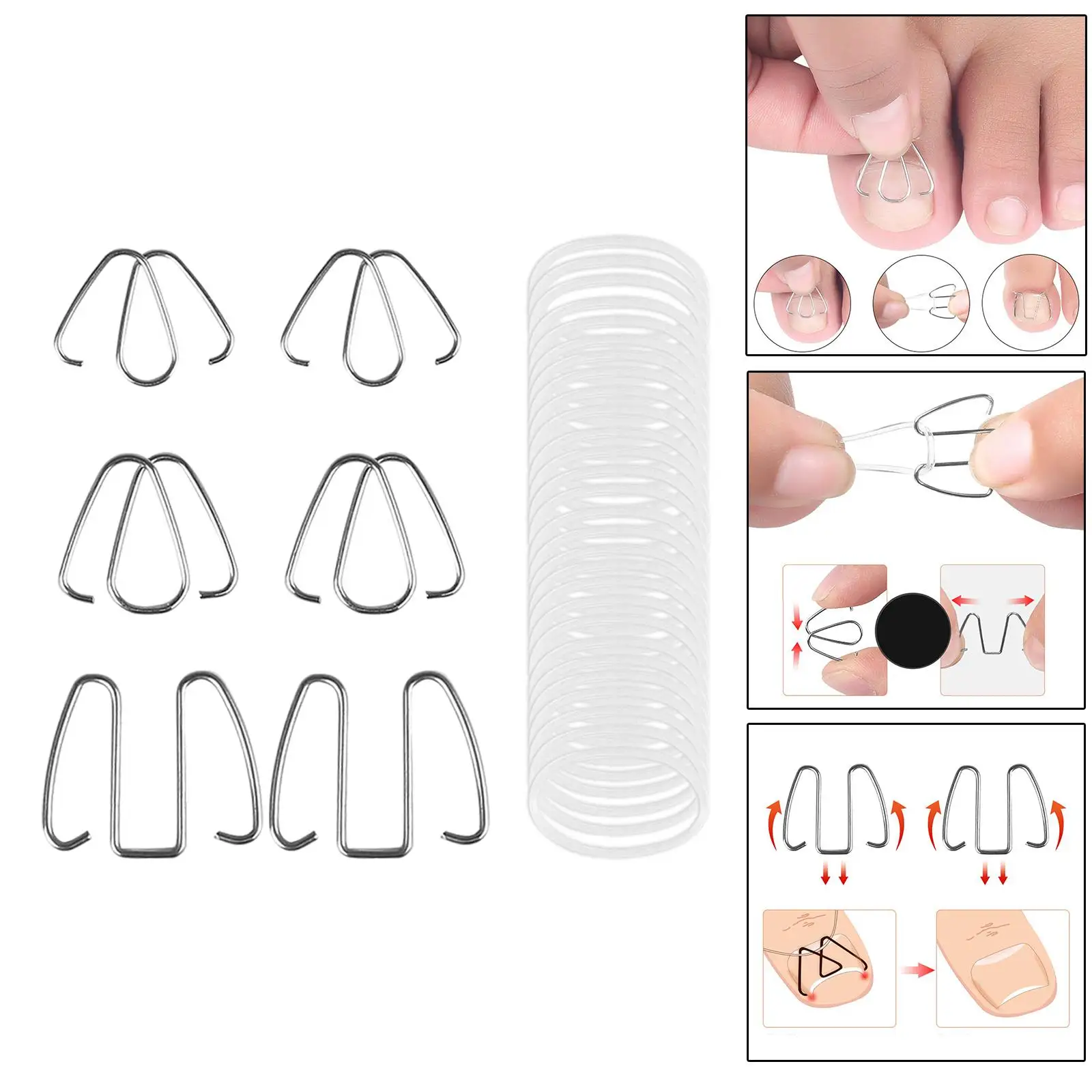 6Pcs Ingrown Toe Nail Correction Wire with 30 Rubber Rings Relieve Discomfort, Toenail Fixer Nail Correction Hook, Easy to Use