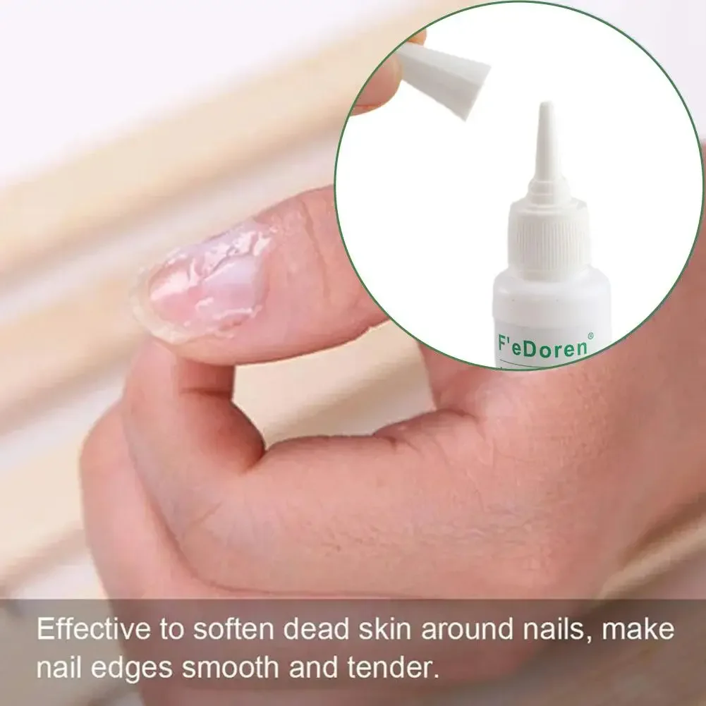 30ML Professional Nail Cuticle Remover Gel Quickly Manicure Nails Dead Care Soften Product Skin DIY Pedicure Cuticle Oil