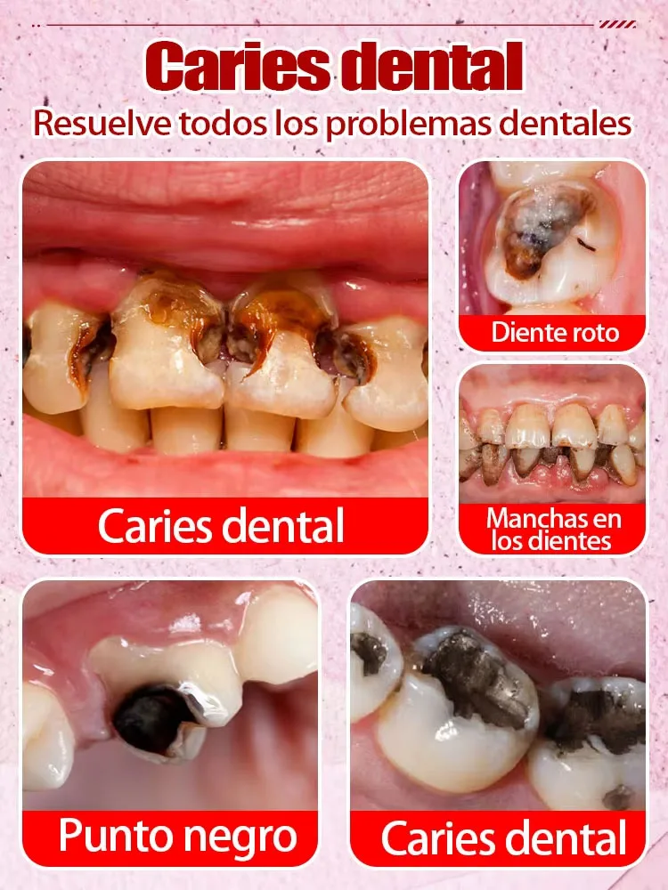يصلح بسهولة على تسوس الأسنان ويمنع تساقط الأسنان وتبييض الأسنان.