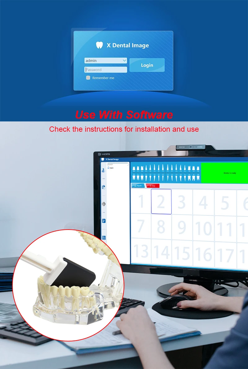 VV Dental Digitaler Röntgen-Bildgebungsdetektor RVG-Sensor mit Intraoralem Bildgebungssystem HD-Bild Radiovisiograph Tragbarer Röntgensensor – Detail 4