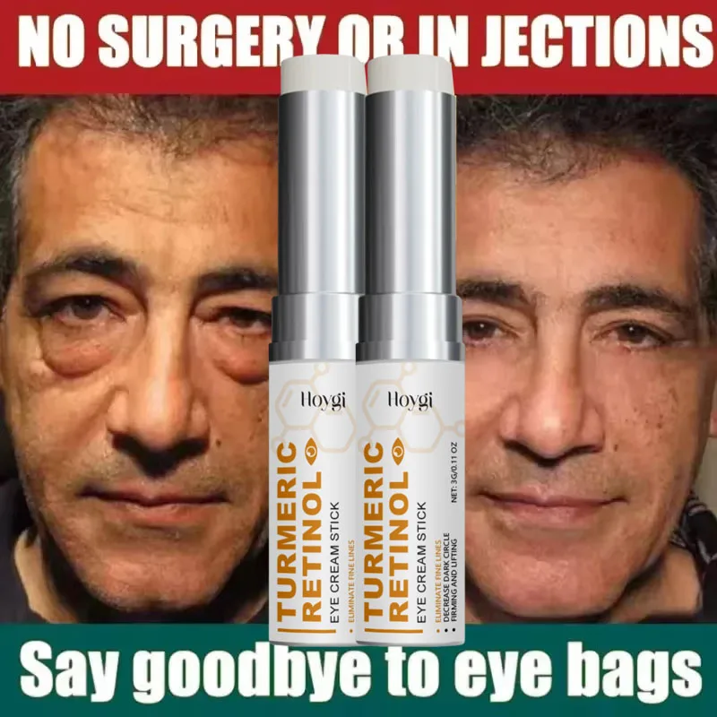 حقيبة العين الفورية إزالة كريم عين جزيئات الدهون الهالات السوداء الانتفاخ تتلاشى الخطوط الدقيقة رفع سطع الجمال الكوري العناية بالعين