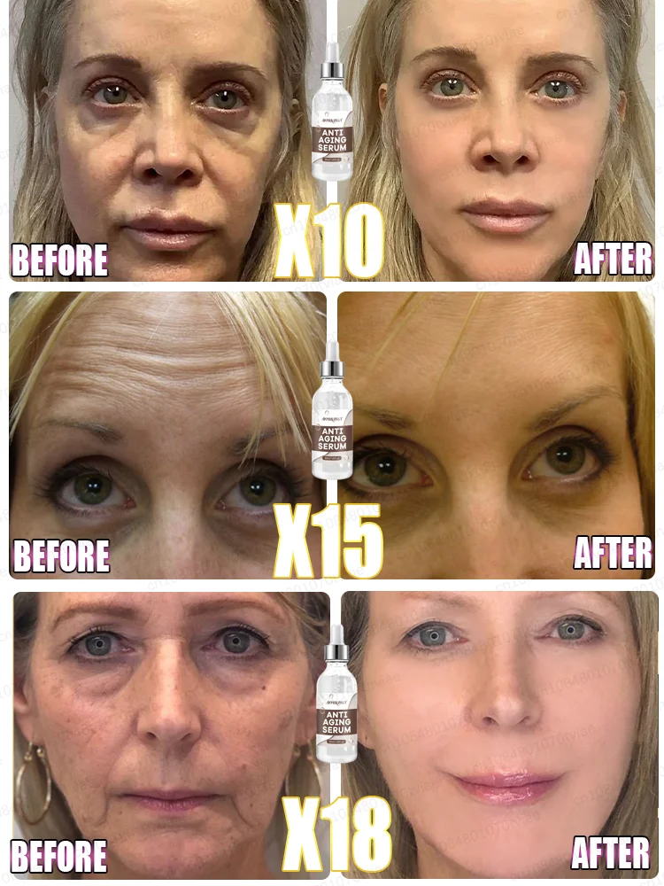 Reduce facial wrinkles